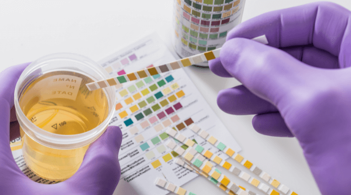 Are You Healthy? Find Out With This Urine Color Chart