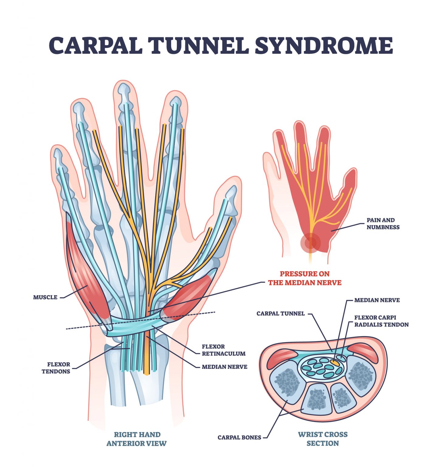 Symptoms, diagnosis and treatments for wrist pain conditions (including ...